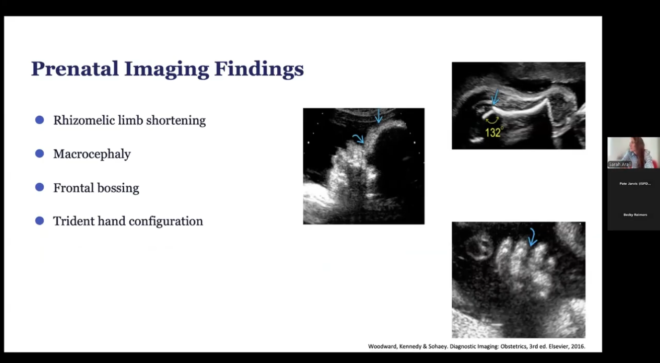 VES Imaging